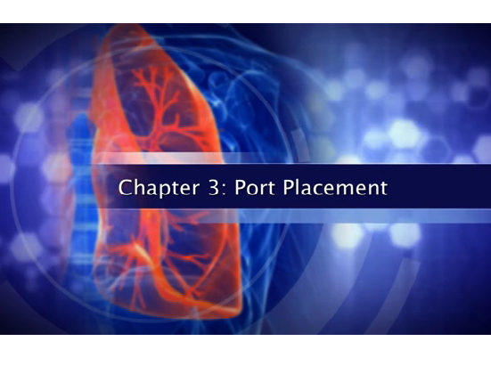 L'atlas du Dr Todd Demmy - lobectomie thoracoscopique - placement du Port
