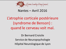 L'atrophie corticale postérieure : quand le cerveau voit mal