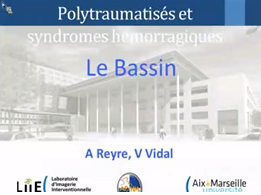 Le bassin Le bassin