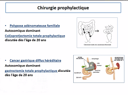 Le point de vue du chirurgien