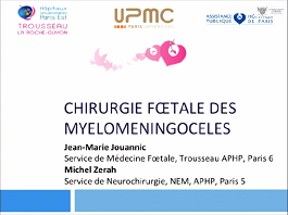 Le point sur la cure chirurgicale du spina bifida in utero Le point sur la cure chirurgicale du spina bifida in utero