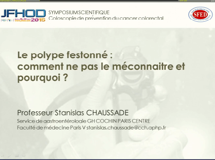 Le polype festonné : comment ne pas le méconnaître et pourquoi ? Le polype festonné : comment ne pas le méconnaître et pourquoi ?
