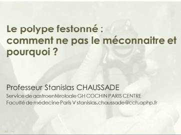 Le polype festonné : comment ne pas le méconnaître et pourquoi ? Le polype festonné : comment ne pas le méconnaître et pourquoi ?