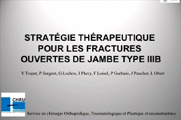 Le traitement tout en un temps en urgence des fractures ouvertes de jambe type III Le traitement tout en un temps en urgence des fractures ouvertes de jambe type III