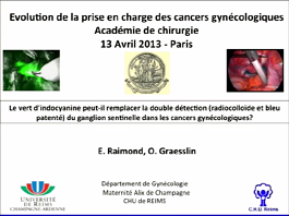 Le vert d'indocyanine peut-il remplacer la double détection (radiocolloïde et bleu patenté) du ganglion sentinelle dans les cancers gynécologiques ?
