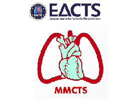 Left anterior small thoracotomy for minimally invasive coronary artery