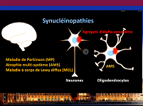 Les agrégats d'alpha-synucléine : un biomarqueur du diagnostic et du pronostic des synucléinopathies ?