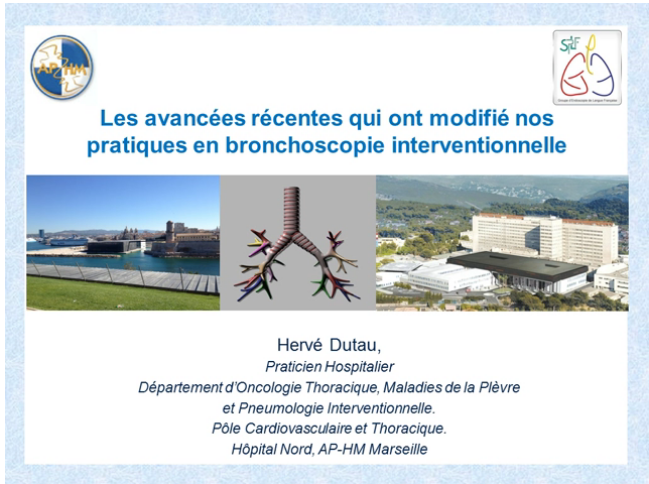 Les avancées récentes qui ont modifie nos pratiques - Endoscopie bronchique interventionnelle Les avancées récentes qui ont modifie nos pratiques - Endoscopie bronchique interventionnelle