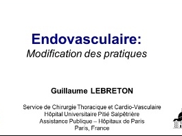 Les avancées récentes qui ont modifie nos pratiques - Chirurgie endovasculaire Les avancées récentes qui ont modifie nos pratiques - Chirurgie endovasculaire