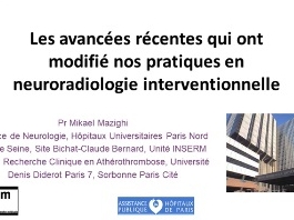 Les avancées récentes qui ont modifie nos pratiques - Neuroradiologie interventionnelle Les avancées récentes qui ont modifie nos pratiques - Neuroradiologie interventionnelle