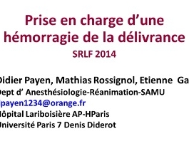 Les complications du peri-partum - Prise en charge d'une hémorragie de la délivrance Les complications du peri-partum - Prise en charge d'une hémorragie de la délivrance