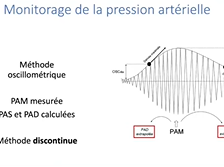 Les différents outils de monitorages