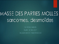 Les fibromes desmoïdes et les sarcomes