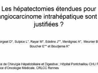 Les hépatectomies étendues sont-elles justifiées dans le cholangiocarcinome intrahépatique ? Les hépatectomies étendues sont-elles justifiées dans le cholangiocarcinome intrahépatique ?