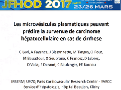 Les microvésicules plasmatiques peuvent prédire la survenue de carcinome hépatocellulaire en cas de cirrhose
