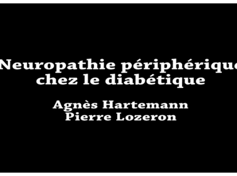 Les neuropathie périphériques chez les diabétiques