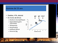 Les nouveaux auto-anticorps dans les neuropathies dysimmunes