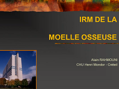 Les spécificités de l'onco-hématologie partie 2