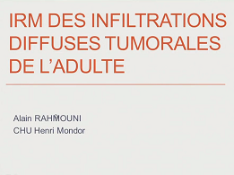 Les spécificités de l'onco-hématologie partie 3