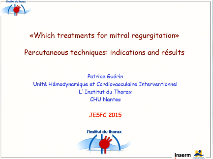 Les téchniques percutanées indications et résultats