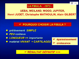 Les transplants diaphyso-épiphysaires de fibula vascularisée pour la reconstruction des os longs chez l'enfant, après résection tumorale