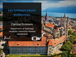 Les tumeurs neuro endocrines