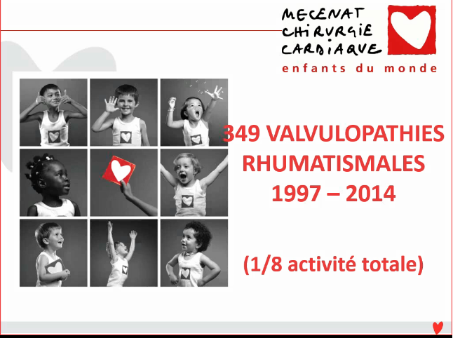 Les valvulopathies rhumatismales opérés chez l'enfant et l'adolescent