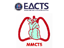Less invasive implantation of HeartWare left ventricular assist device