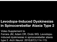 Levodopa-Induced Dyskinesias in Spinocerebellar Ataxia Type 2 Levodopa-Induced Dyskinesias in Spinocerebellar Ataxia Type 2