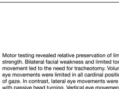 Limited Volitional Eye Movements Limited Volitional Eye Movements