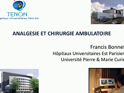 L'impact de la chirurgie ambulatoire sur la prise en charge post-opératoire