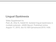 Lingual Dyskinesia Lingual Dyskinesia