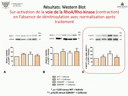 L'inhibition de la voie de la RhoA/Rho-kinase