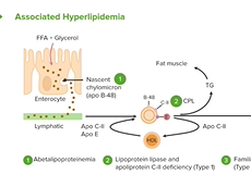 Lipid Digestion & Hyperlipidemia Lipid Digestion & Hyperlipidemia