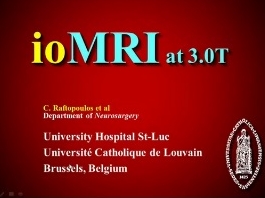 L'IRM, un outil indispensable d'un bloc de neurochirurgie du XXIème siècle