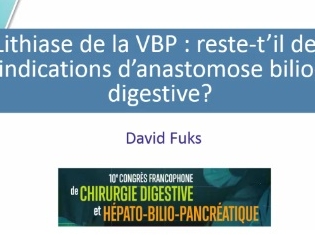 Lithiase VBP : reste-t-il des indications d’anastomose bilio-digestive ?