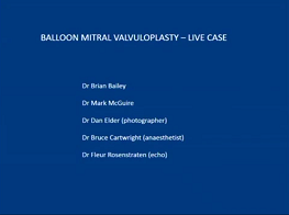 Live case of balloon mitral valvuloplasty