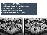 Live différé (1) Live différé (1)