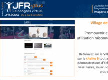 Live JFR.plus Live JFR.plus