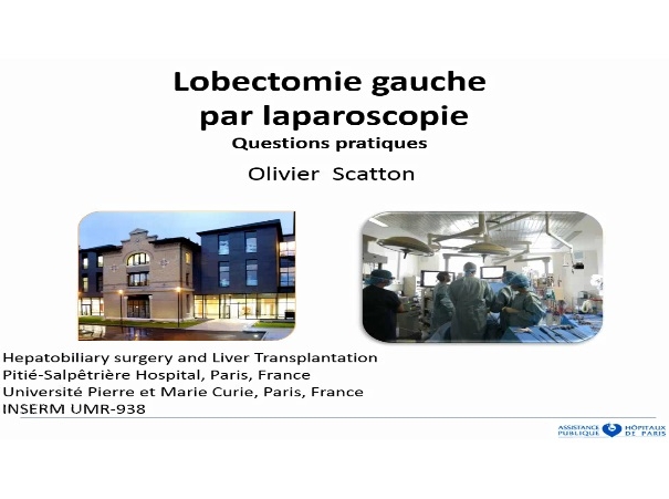 Lobectomie hépatique gauche laparoscopique