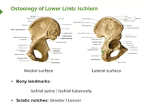 Lower Limb: Surface Anatomy & Osteology - Anatomy Lower Limb: Surface Anatomy & Osteology - Anatomy