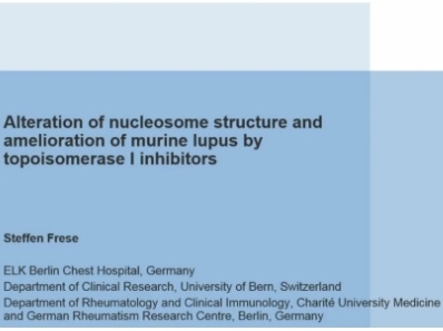 Lupus Nephritis and Irinotecan Lupus Nephritis and Irinotecan