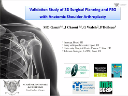 L'utilisation des guides patients spécifiques optimise la pose des prothèses totales anatomiques d'épaule