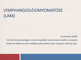 Lymphangioléiomyomatose