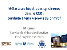 Métastases hépatiques synchrones du cancer colorectal : conduite à tenir vis-à-vis du primitif Métastases hépatiques synchrones du cancer colorectal : conduite à tenir vis-à-vis du primitif