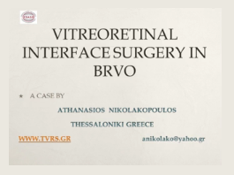 Œdème maculaire dans les occlusions veineuses rétiniennes - La chirurgie vitréo-rétinienne d'interface Œdème maculaire dans les occlusions veineuses rétiniennes - La chirurgie vitréo-rétinienne d'interface
