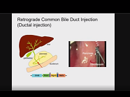 Making New Beta Cells by Reprogramming Making New Beta Cells by Reprogramming
