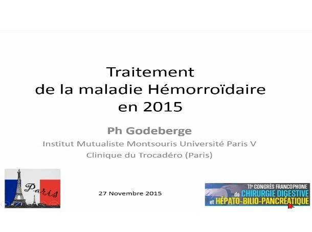 Maladie hémorroïdaire–traitement en 2015