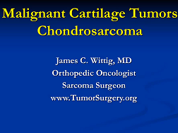 Malignant Cartilage Tumors (Chondrosarcoma)