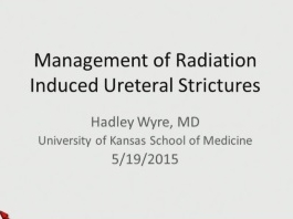 Management des radiations  induites sur la structure urétrale